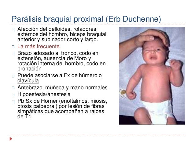 paralisis de erb duchenne pdf download erb duchenne